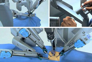 robotic-surgery-dr.k.ramesh