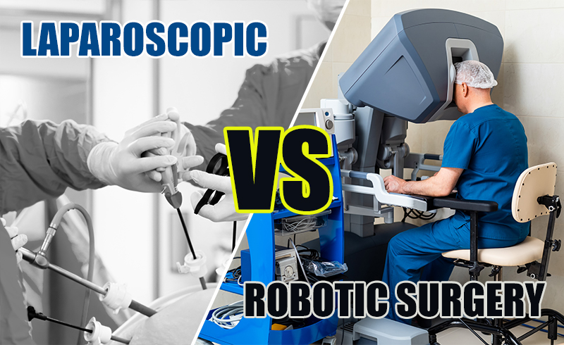 Laparoscopic Vs Robotic Surgery In Urology Ashvin Clinic Dr K Ramesh Centre For Urology 