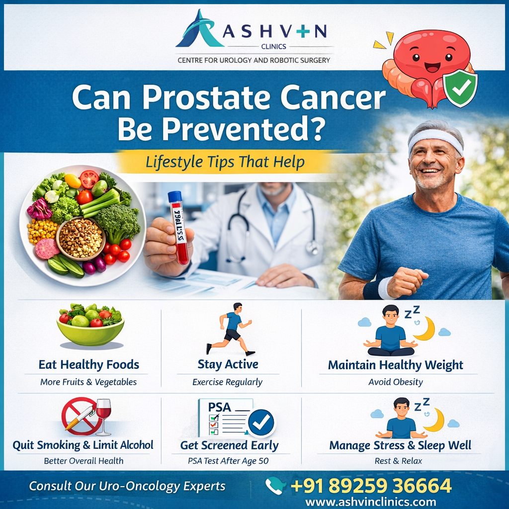 Can Prostate Cancer Be Prevented? Lifestyle Tips That Help