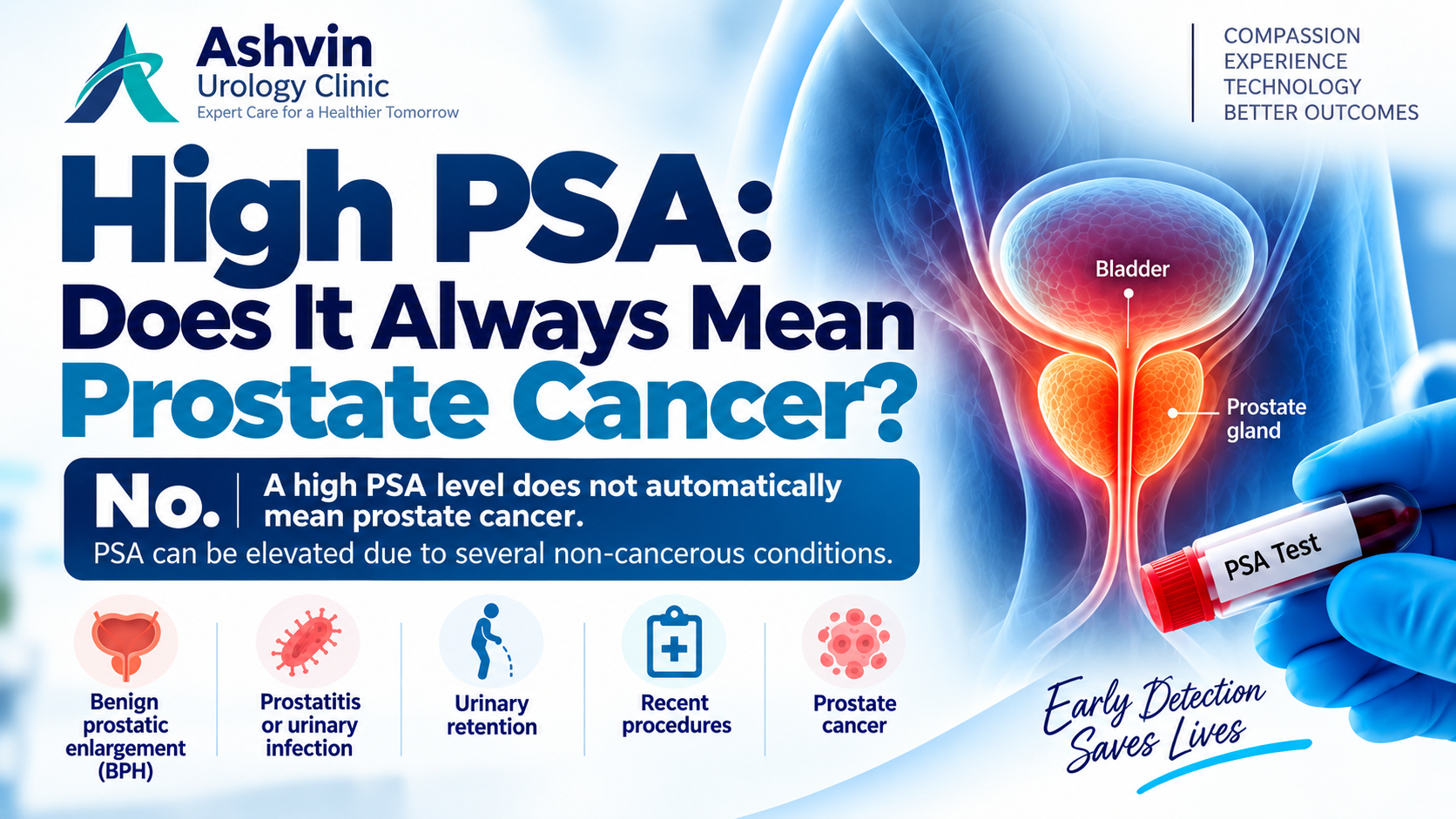 High PSA Level: What It Means and When to See a Urologist